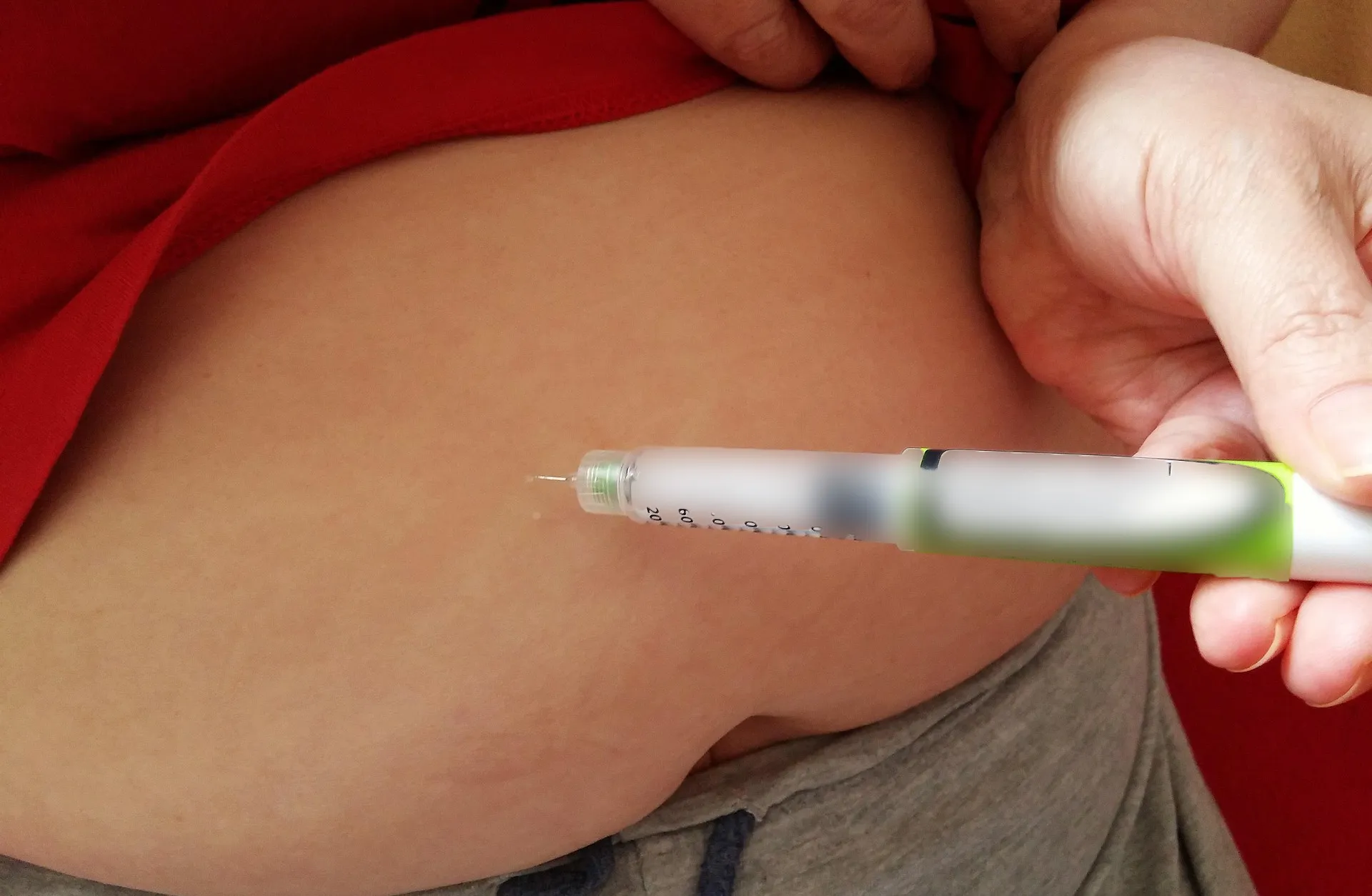 糖尿病患者持續增加，且發病年齡年輕化，40歲前「早發」糖尿病與肥胖息息相關。肥胖導致胰島素阻抗，使血糖控制困難，並增加異位脂肪堆積風險，進一步惡化病情，形成糖胖症的惡性循環。治療趨勢已從單純控糖轉向「ABBCDE」策略，涵蓋血糖、血壓、膽固醇、體重管理、藥物與運動。新型腸泌素類藥物可同時降低血糖與體重，減少併發症風險。未來糖尿病藥物將發展長效降糖、安全性提升與體重管理，提高患者依從性與治療效果。