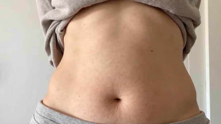 女性腹部脂肪展示,顯示初老徵兆及體脂上升。