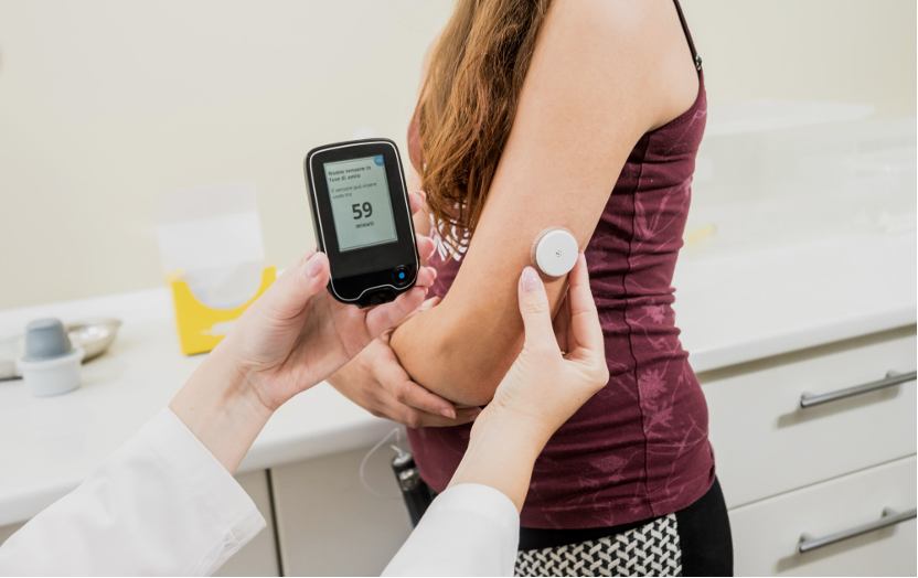 奇美醫院內分泌新陳代謝科彭瓊慧醫師表示，連續血糖監測器（CGM）能協助患者即時掌握血糖曲線，發現餐後及點心時段的血糖波動盲點，並根據個人化數據調整飲食，有效提升控糖精準度與健康管理成效。