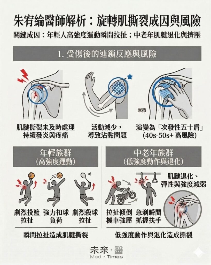 搭車急剎拉扯肩痛非小事?旋轉肌撕裂未處理恐變次發性五十肩:避免再發生「運動是關鍵」 3 Gemini Generated Image 6dvg1f6dvg1f6dvg