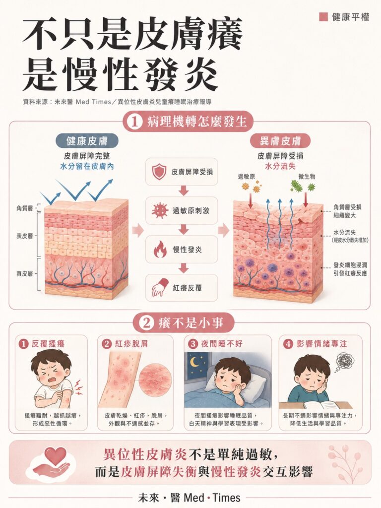 異位性皮膚炎不只是皮膚癢!還要注意孩童睡不好、長不高與感染風險 2 異位性皮膚炎屬慢性皮膚發炎,蕁麻疹常見突然紅腫且短時間消退