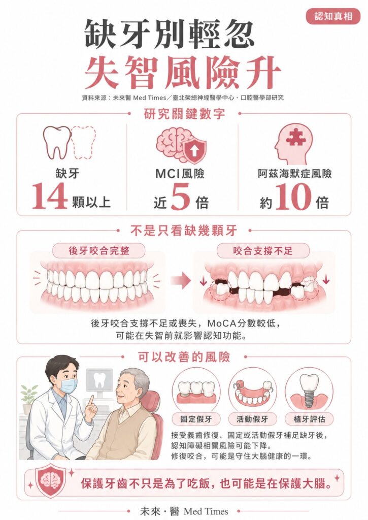 缺牙14顆以上與輕度認知障礙、阿茲海默症風險升高相關，咬合支撐不足可能影響認知功能