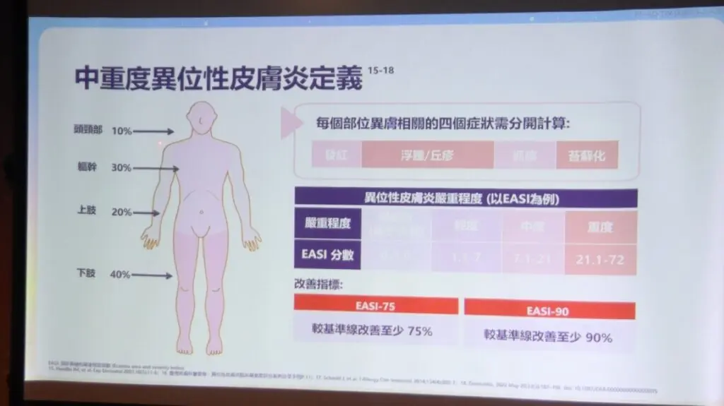 IL-13生物製劑納入健保提供中重度異位性皮膚炎治療新選項
