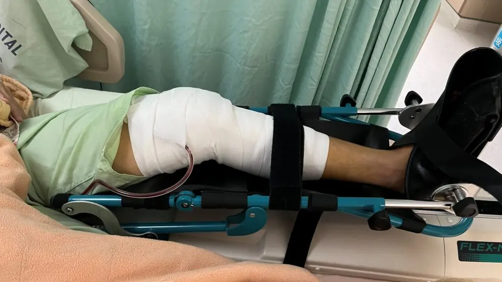 盧女士接受全膝關節置換後，左膝以紗布包紮並接受病床照護，後續銜接行走訓練。